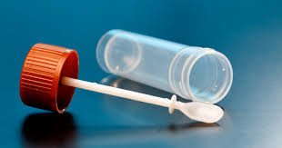 Calprotectin Test